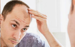 Photo of man inspecting his baldness in a mirror