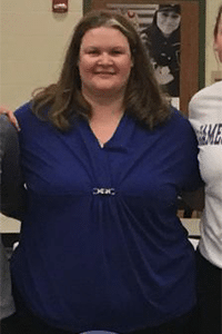 Before Weight loss before photo